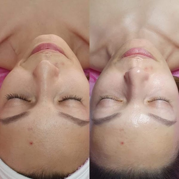 Sandra Estetik zdravotná Pedikura,Medicinalna Pedikura,kozmetické študio