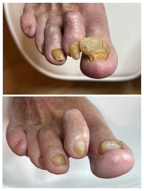 T-Studio Podológia - Pedikúra Bardejov