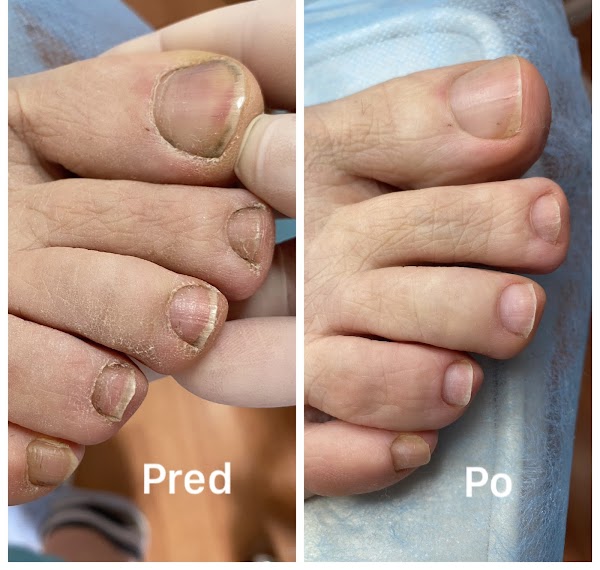 Pedikérsky salón Tetiana Drahomyretska